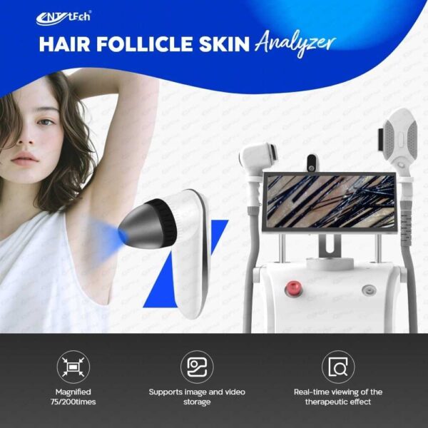 New Design 808 Diode Laser Hair Removal Machine 800-1.200-1.500 W - Image 16