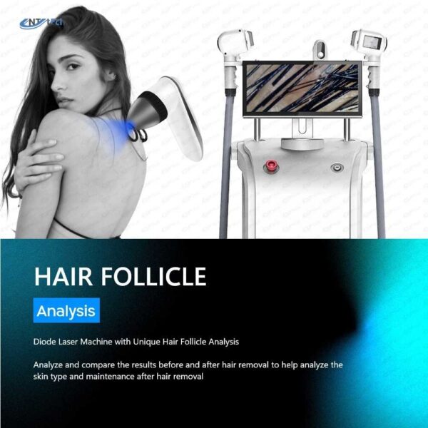 New Design 808 Diode Laser Hair Removal Machine 800-1.200-1.500 W - Image 12