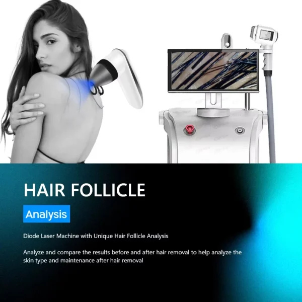 New Design 808 Diode Laser Hair Removal Machine 800-1.200-1.500 W - Image 6