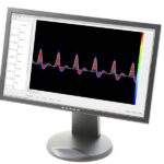 Dopplex® Vascular Reporter Software Λογισμικό Αγγειολογικών Doppler Huntleigh