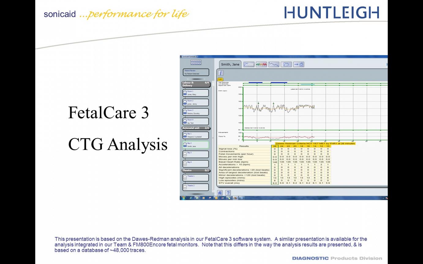 Λογισμικό Ανάλυσης & Απεικόνισης Καρδιοτοκογράφων FetalCare3 Huntleigh - Image 4
