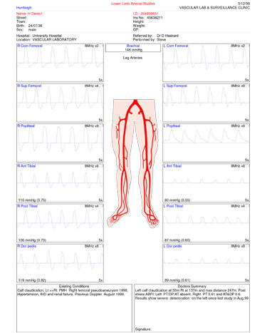 Doppler Αγγείων Sonicaid DMX με Κεφαλή 10MHz - Image 4