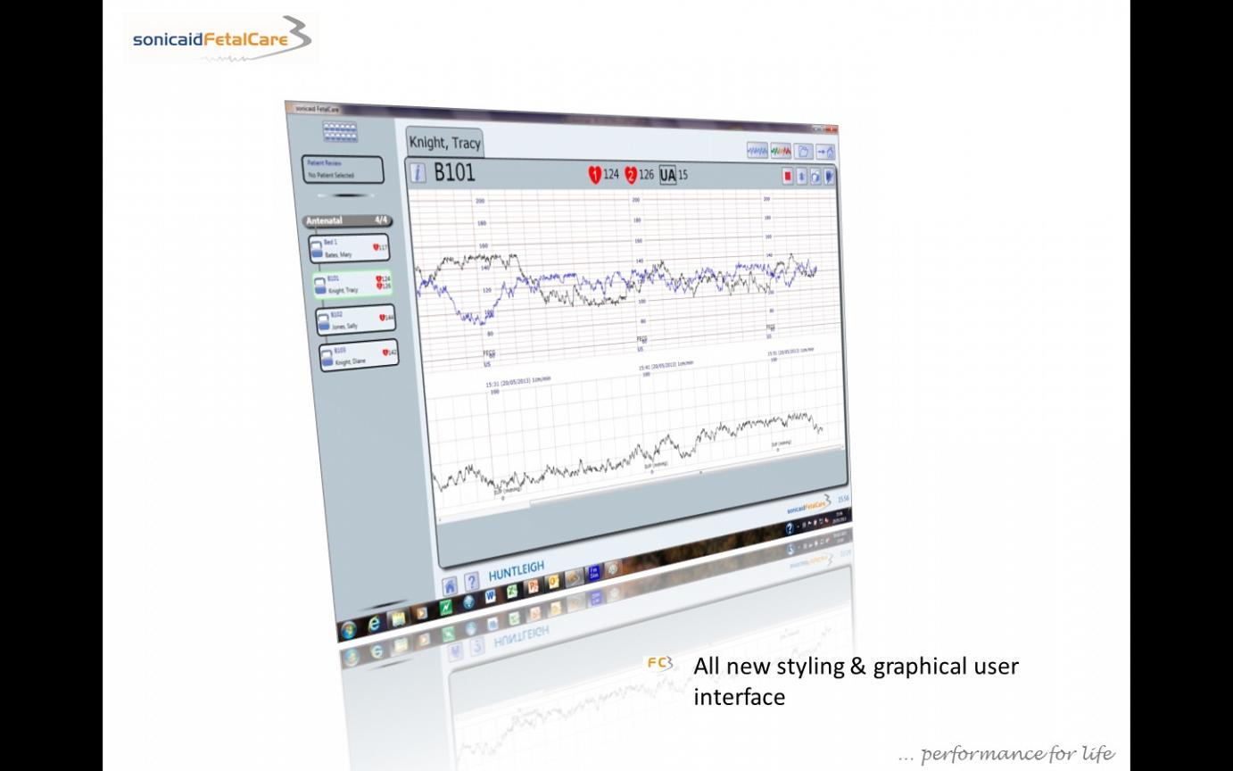 Λογισμικό Ανάλυσης & Απεικόνισης Καρδιοτοκογράφων FetalCare3 Huntleigh - Image 2