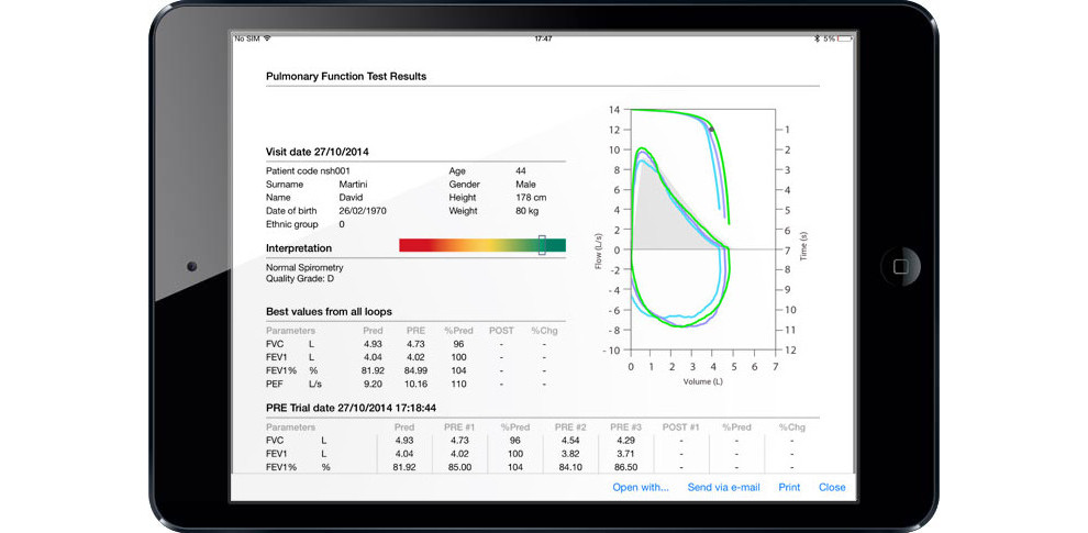 Σπιρόμετρο MIR Spirobank II Advanced Plus με Οξυμετρία και Τουρμπίνα Πολλαπλών Χρήσεων - Image 7