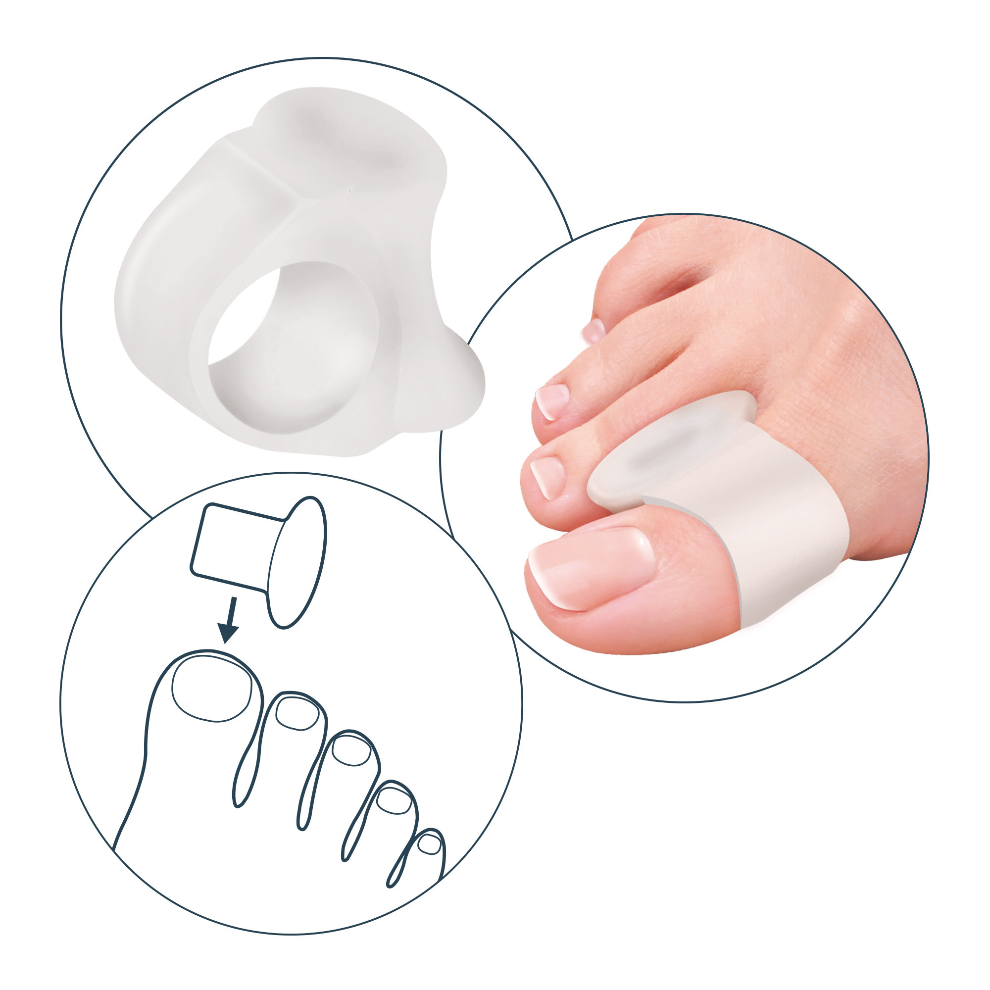 Alluxcare Διαχωριστικό Μεγάλου Δακτύλου με Gel Ring 1τμχ - Image 4