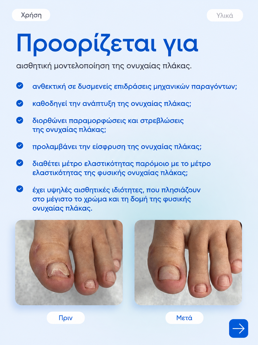 Ρευστή Μάζα PODOLJEST 1.5gr – Φωτοπολυμεριζόμενη Υγρή Μάζα Ροής - Image 3